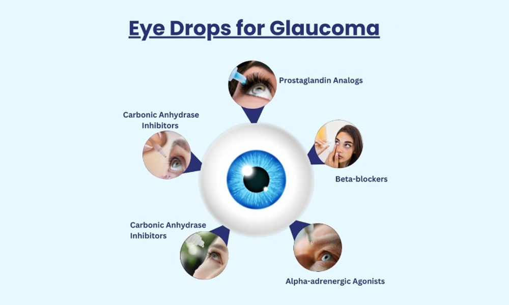 Glaucoma Treatment