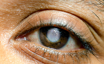 glaucoma diagnostic equipment