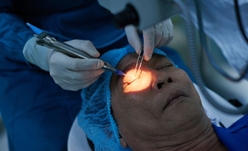 glaucoma laser treatment